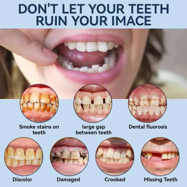 SmileFitPro® – 𝐌𝐞𝐝𝐢𝐜𝐚𝐥𝐅𝐢𝐭 𝐀𝐝𝐚𝐩𝐭𝐢𝐯𝐞 𝐃𝐞𝐧𝐭𝐮𝐫𝐞𝐬🦷Suitable for all mouth shapes, perfect fit🦷(⏰Limited time 50% off, last 30 minutes⏰)