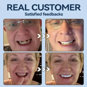 SmileFitPro® – 𝐌𝐞𝐝𝐢𝐜𝐚𝐥𝐅𝐢𝐭 𝐀𝐝𝐚𝐩𝐭𝐢𝐯𝐞 𝐃𝐞𝐧𝐭𝐮𝐫𝐞𝐬🦷Suitable for all mouth shapes, perfect fit🦷(⏰Limited time 50% off, last 30 minutes⏰)