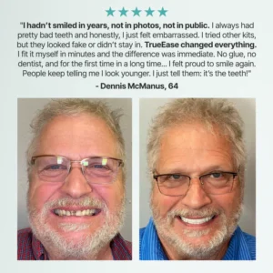 SmileCraft™ Custom-Fit Functional Dentures
