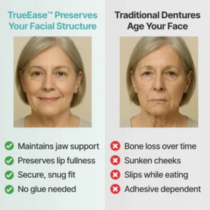 SmileCraft™ Custom-Fit Functional Dentures
