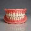 SmileCraft™ Custom-Fit Functional Dentures