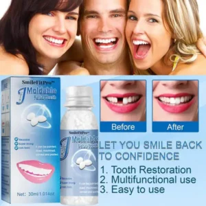 🦷 SmileFitPro™ Dental Filling Gel – Pain-Free, Drill-Free Cavity Solution💖💖