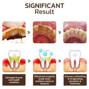 SmileFitPro™ Niacinamide Whitening Toothpaste
