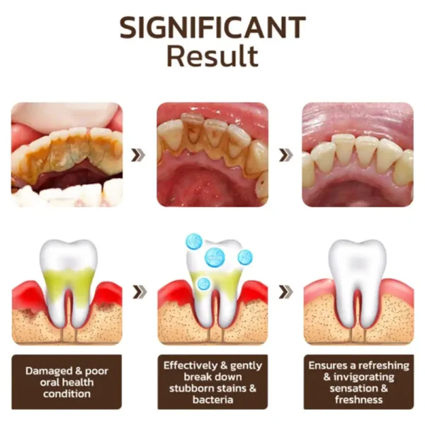 SmileFitPro™ Niacinamide Whitening Toothpaste