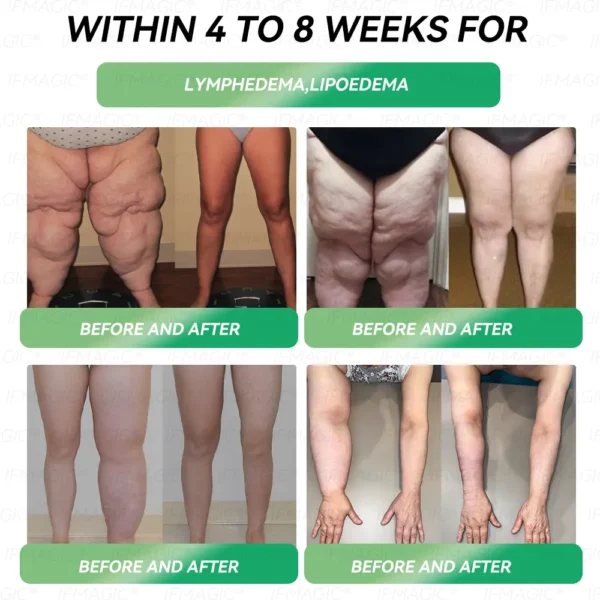 𝐑𝒆𝒔𝐮𝐥𝐭𝐬 𝒊𝒏 𝟕 𝐝𝒂𝐲𝐬✅𝐁𝐨𝒔𝒕𝗼𝗿𝗲® 𝐺𝑳𝐏 -1 𝐌𝐢𝐜𝒓𝒐𝒄𝒂𝒑𝘀𝘂𝗹𝗲 𝗕𝘂𝗿𝐬𝐭 𝑷𝒂𝙩𝙘𝙝🌱𝐎𝐛𝐞𝐬𝐢𝐭𝐲,𝑪𝒂𝒓𝒅𝒊𝒐𝒗𝒂𝒔𝒄𝒖𝒍𝒂𝒓 𝑫𝒊𝒔𝒆𝒂𝒔, 𝗗𝗶𝗮𝗯𝗲𝘁𝗲𝘀, 𝗦𝗹𝗲𝗲𝗽 𝗔𝗽𝗻𝗲𝗮, 𝐉𝐨𝐢𝐧𝐭 𝐏𝐫𝐨𝐛𝐥𝐞𝐦𝐬, 𝐚𝐧𝐝 𝐌𝐨𝐫𝐞