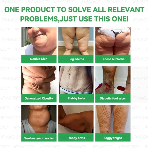 𝐑𝒆𝒔𝐮𝐥𝐭𝐬 𝒊𝒏 𝟕 𝐝𝒂𝐲𝐬✅𝐁𝐨𝒔𝒕𝗼𝗿𝗲® 𝐺𝑳𝐏 -1 𝐌𝐢𝐜𝒓𝒐𝒄𝒂𝒑𝘀𝘂𝗹𝗲 𝗕𝘂𝗿𝐬𝐭 𝑷𝒂𝙩𝙘𝙝🌱𝐎𝐛𝐞𝐬𝐢𝐭𝐲,𝑪𝒂𝒓𝒅𝒊𝒐𝒗𝒂𝒔𝒄𝒖𝒍𝒂𝒓 𝑫𝒊𝒔𝒆𝒂𝒔, 𝗗𝗶𝗮𝗯𝗲𝘁𝗲𝘀, 𝗦𝗹𝗲𝗲𝗽 𝗔𝗽𝗻𝗲𝗮, 𝐉𝐨𝐢𝐧𝐭 𝐏𝐫𝐨𝐛𝐥𝐞𝐦𝐬, 𝐚𝐧𝐝 𝐌𝐨𝐫𝐞