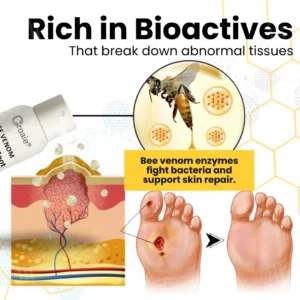 🌟 Official Store | Croaie® Bee Venom Diabetic Foot Ulcer Spray