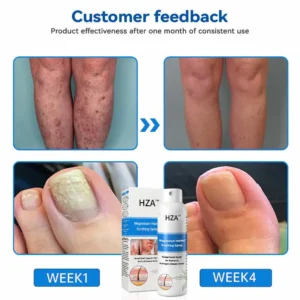 HZA™ Magnesium Herbal Psoriasis Spray