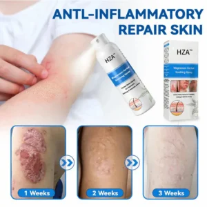 HZA™ Magnesium Herbal Psoriasis Spray