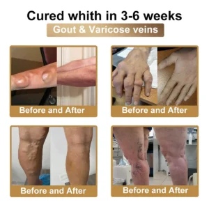 PolarFresh® Bee Venom & Botulinum Toxin Joint Pain Relief & Repair Cream– Fast Relief & Joint Repair