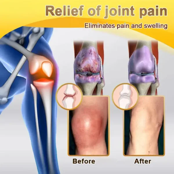 PolarFresh® Bee Venom & Botulinum Toxin Joint Pain Relief & Repair Cream– Fast Relief & Joint Repair