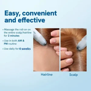 Slimoly™ Advanced Anti-Hair Loss Roll-On – See hair growth in 1-2 weeks