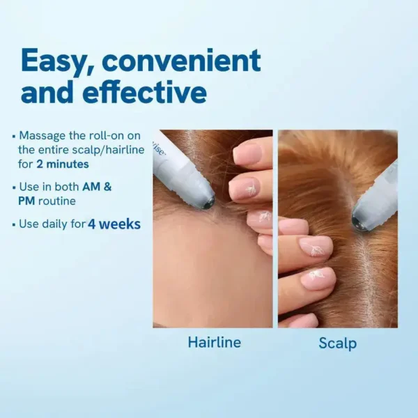 Slimoly™ Advanced Anti-Hair Loss Roll-On – See hair growth in 1-2 weeks