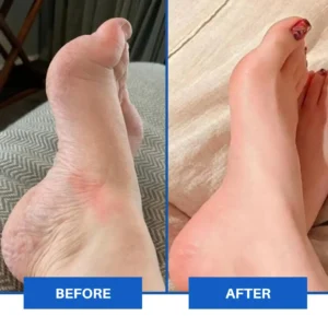 TAILEDEN™ Advanced EMS Foot Massager