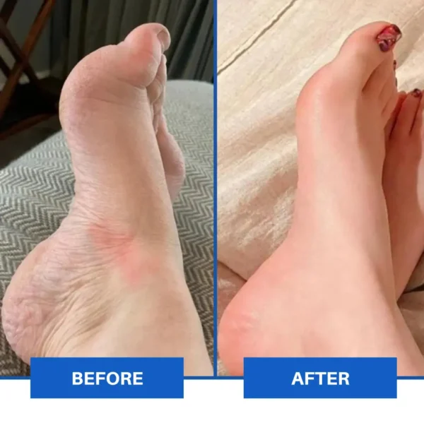 TAILEDEN™ Advanced EMS Foot Massager