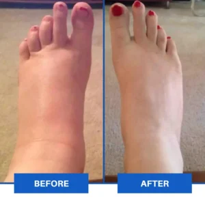 TAILEDEN™ Advanced EMS Foot Massager