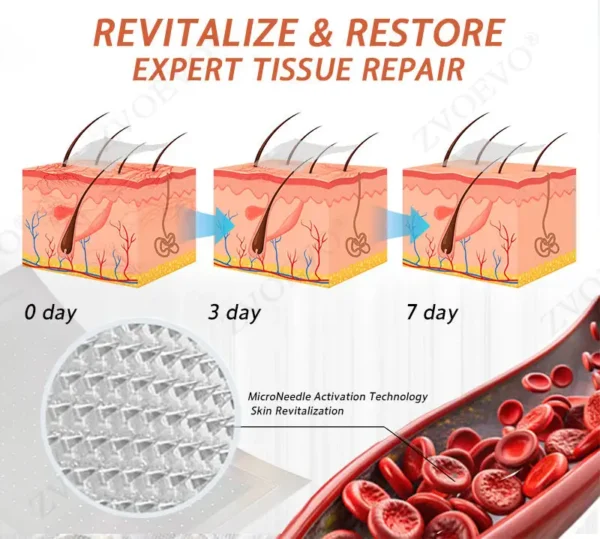 🎁💐Zvoevo® Vein Ease Microneedle Care Patch(For Spider Veins, Varicose Veins, Swelling & Leg Fatigue)