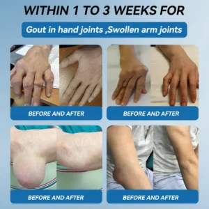 𝖯𝗂𝖼𝗱𝗼® BPC-157 Joint Healing Cream