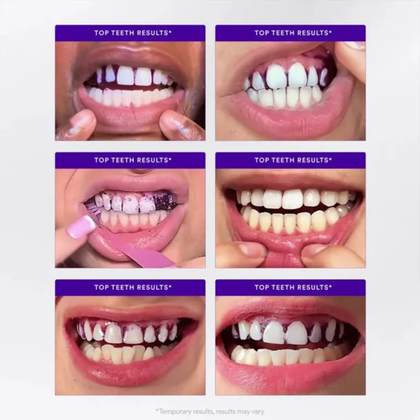AQA™ Whitening Strips
