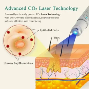 Bikenda® HPV ULTRA Genital Warts Removal Laser Pen