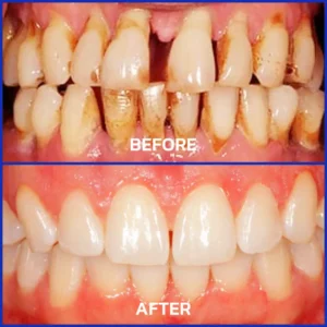 Cougex® VioGloss Bee Venom Dental Therapy Oral Power