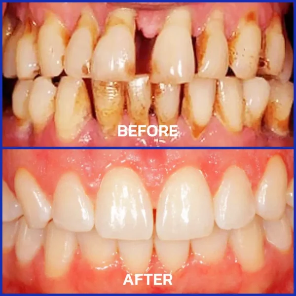 Cougex® VioGloss Bee Venom Dental Therapy Oral Power