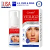 Croaie® Vitiligo Treatment Spray