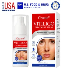 Croaie® Vitiligo Treatment Spray