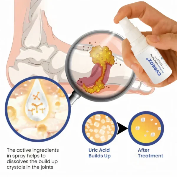 Cvreoz® GoutEase Relief Spray