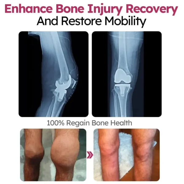 Glodmer™ Advanced Joint & Bone Renewal Cream