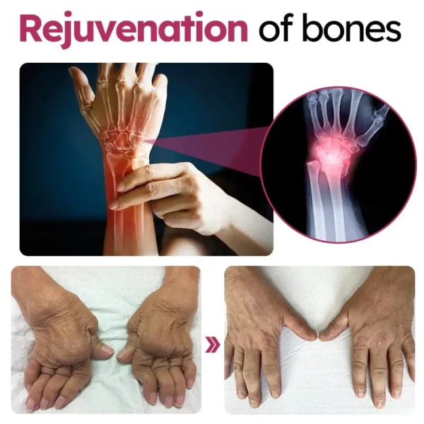 Glodmer™ Advanced Joint & Bone Renewal Cream