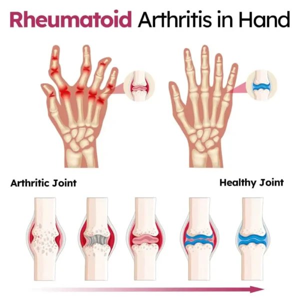 Glodmer™ Advanced Joint & Bone Renewal Cream