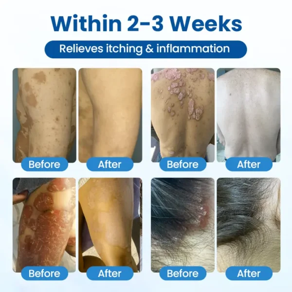 Glowrizon® Magnesium Herbal Treatment Spray
