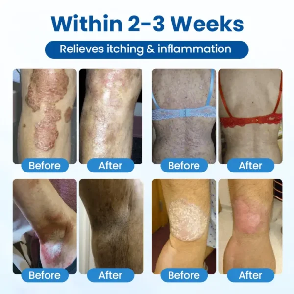 Glowrizon® Magnesium Herbal Treatment Spray