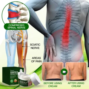 Glowrizon® Sciatoliv Sciatica Relief Cream