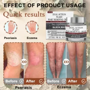 LOVILDS® Black Rice Skin Repair Essence Cream
