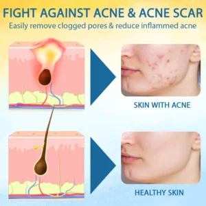 LOVILDS® Psoriasis Care Mellifera Venom Skin Healing Spray🐝〰️