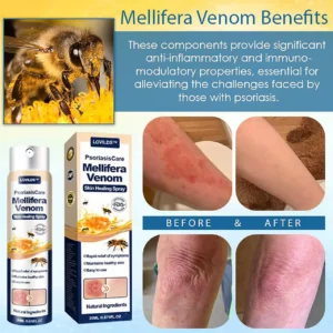 LOVILDS® Psoriasis Care Mellifera Venom Skin Healing Spray🐝〰️