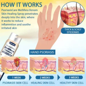 LOVILDS® Psoriasis Care Mellifera Venom Skin Healing Spray🐝〰️
