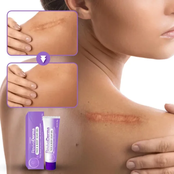 LOVILDS® RevivaDerma Face & Body Scar Gel