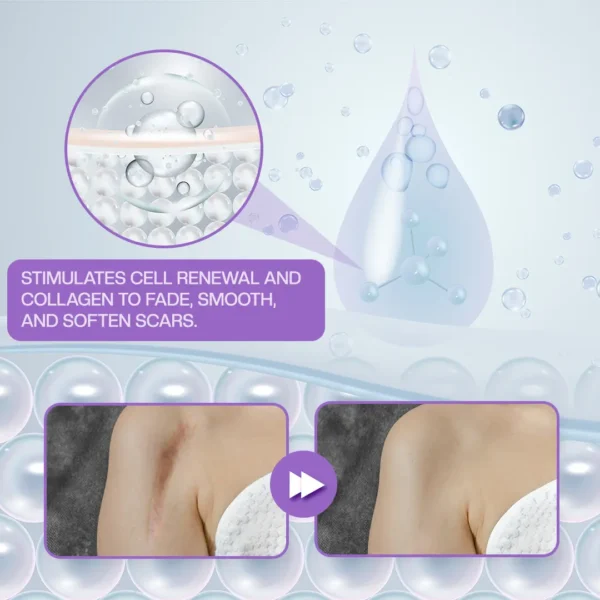 LOVILDS® RevivaDerma Face & Body Scar Gel