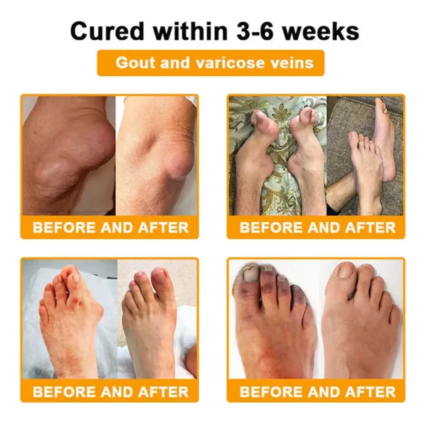 Myo Clinic BEE VENOM LITHOSPERMUM Pain-Relief Bone Healing Cream