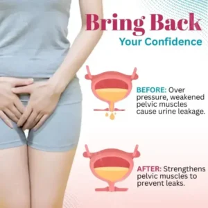 Piguiay® Bladder Control Patch