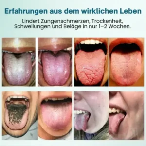 Piguiay® ProShield Zungenreinigungs-Spray