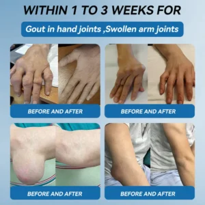LOVILDS™ BPC-157 Joint Healing Cream
