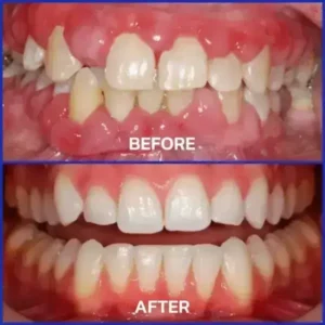 Rolimey® VioCore Bee Venom Dental Treatment Toothpaste