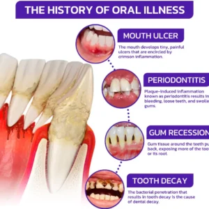 BBOJI™ Bee Venom Dental Treatment Toothpaste