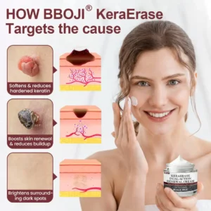 BBOJI® KeraErase Dual-Action Renewal Cream