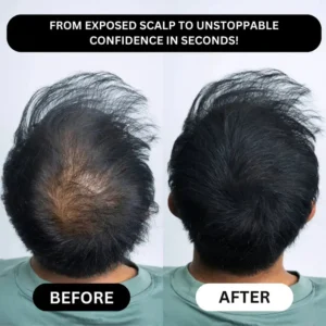 Misspone™ - Densify