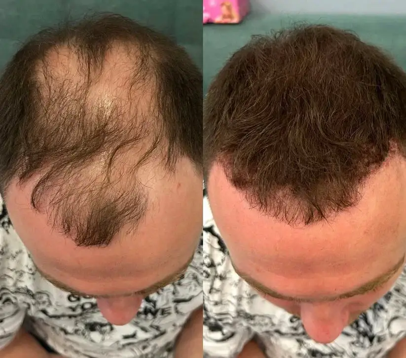 Misspone™ - Densify